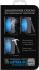 DF xSteel-01 для Sony Xperia Z2 Защитные Стекла инструкция, поддержка, форум, описание, мануал