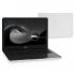 Dell Inspiron 5565, 5565-7469 Ноутбук инструкция, поддержка, форум, описание, мануал