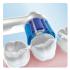 Oral-B EB20 Насадка для электрической зубной щетки инструкция, поддержка, форум, описание, мануал