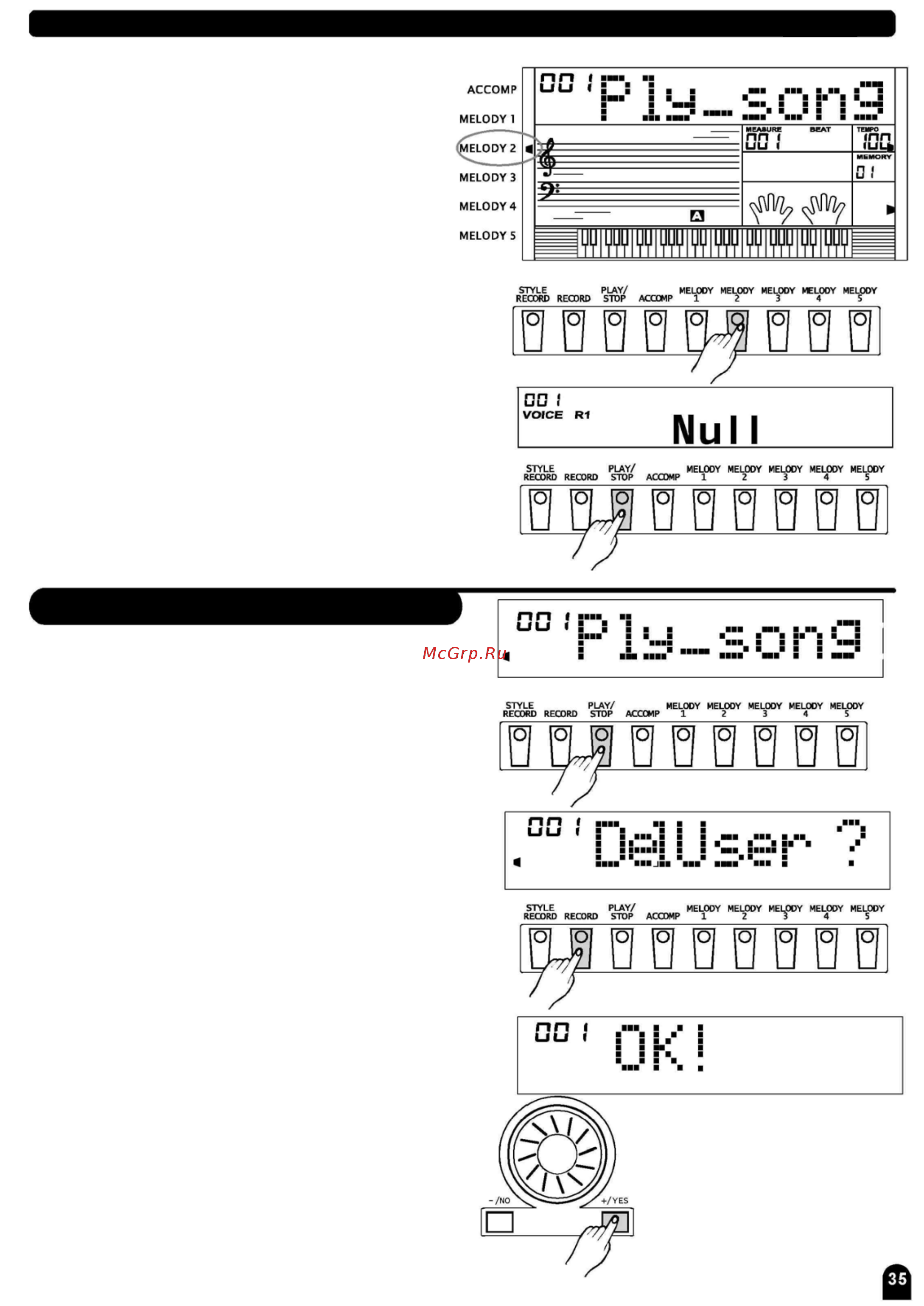 Medeli MD 700 [35/73] Удаление записанной песни