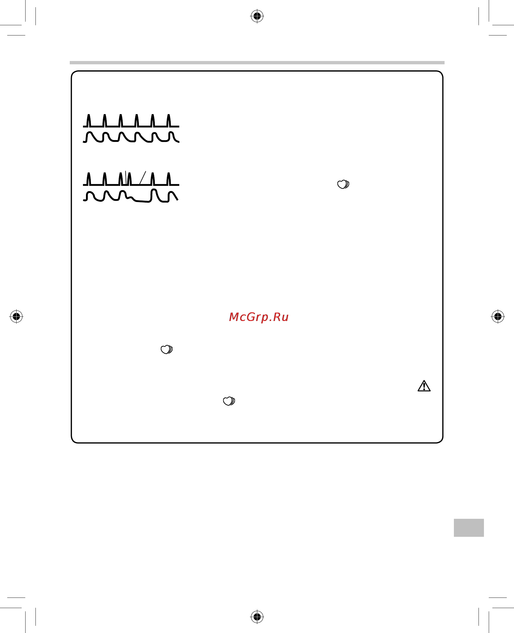 Omron MIT Elite [313/336] ﺐﻠﻘﻟﺍ ﺕﺎﺑﺮﺿ ﻡﺎﻈﺘﻧﺍ ﻡﺪﻌﺑ ﺩﻮﺼﻘﻤﻟﺍ ﺎﻣ