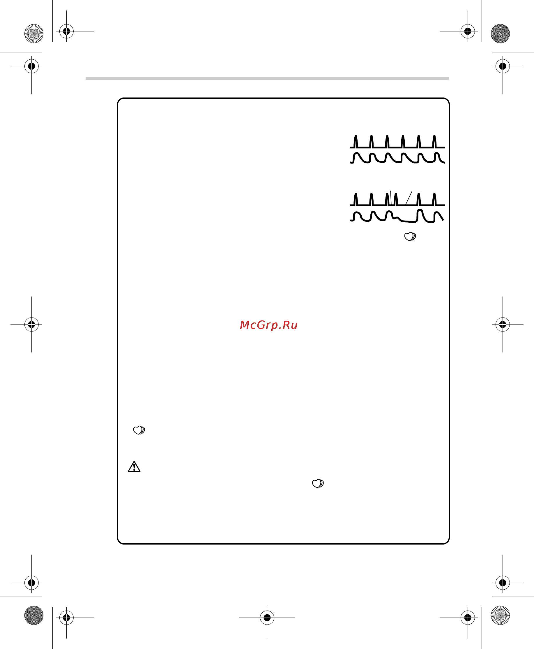 Omron SpotArm i-Q132 [30/400] What is irregular heartbeat