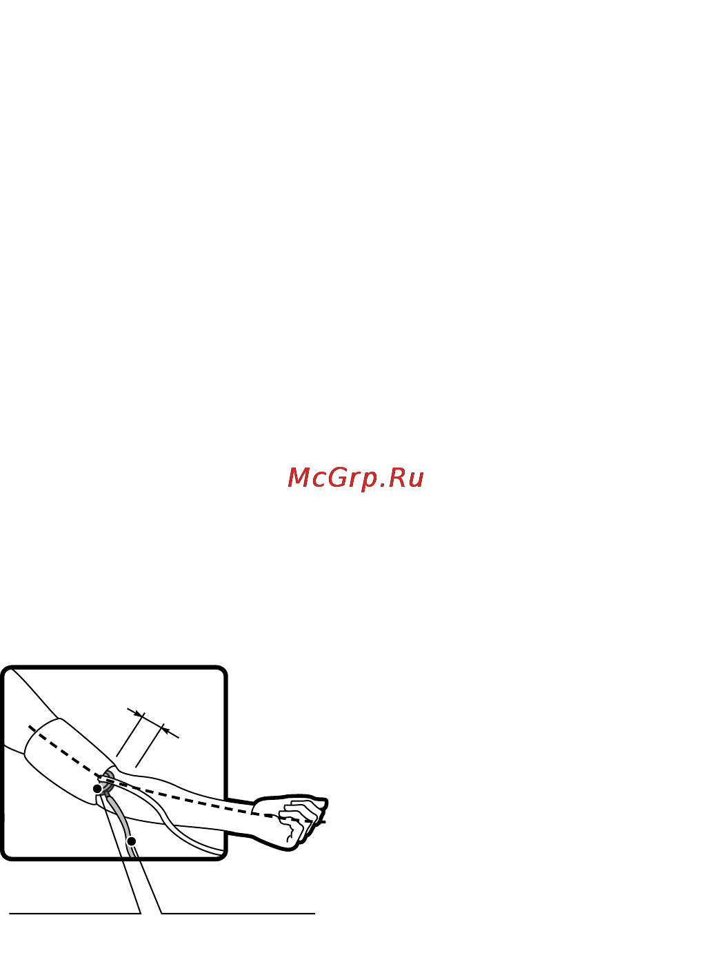 Cs Medica CS-105 [6/20] Определение точки наибольшей пульсации плечевой артерии