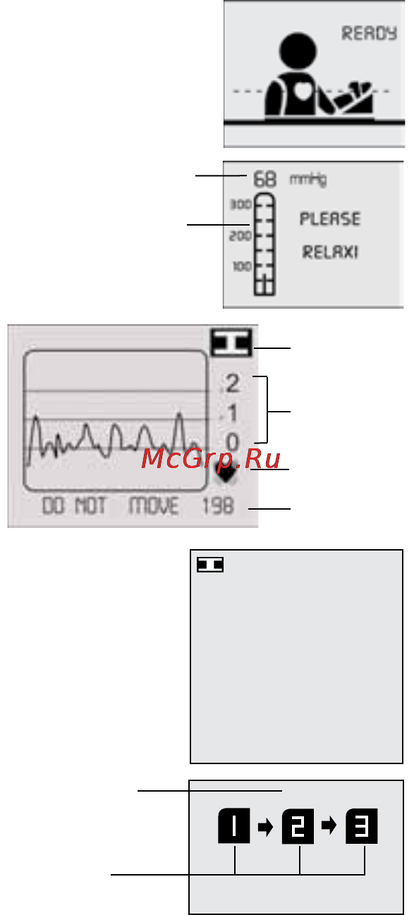 Microlife BP 3AX1 [46/52] 03 15 48