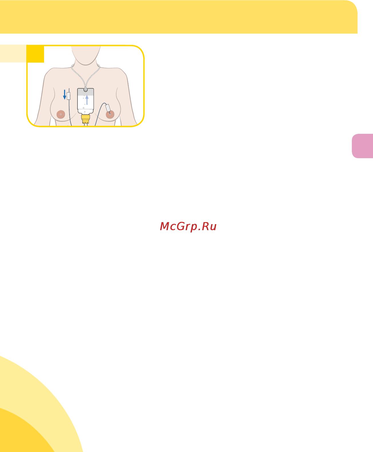 Medela sns имитация грудного вскармливания [73/220] Somministrazione