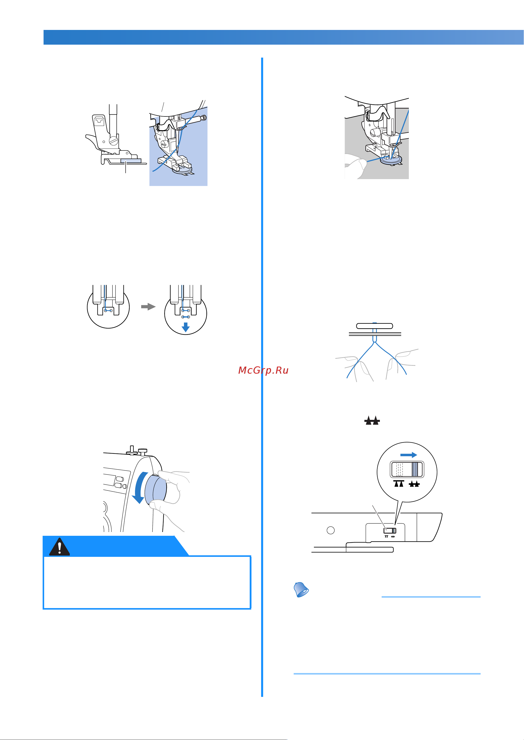 Brother Innov-is 10 Anniversary NV 10 [62/104] Пуговица на месте