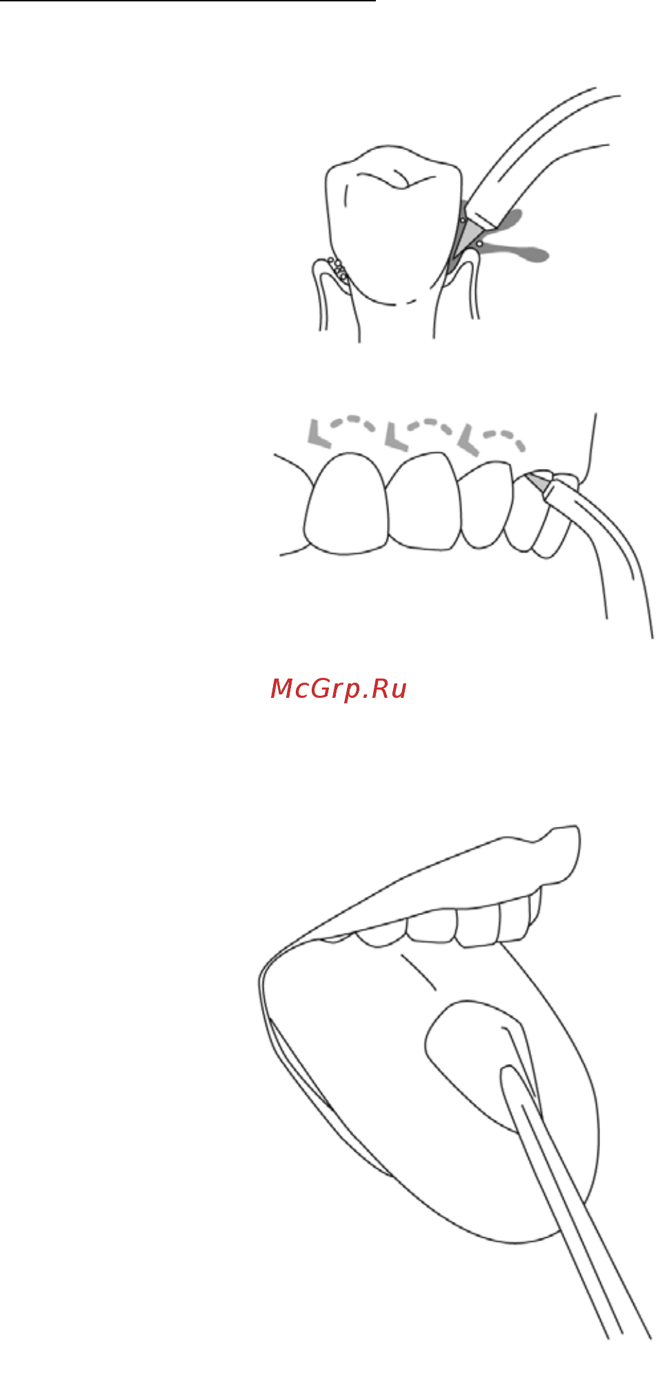 Waterpik WP-112 E2 Ultra Инструкция по эксплуатации онлайн [9/11] 302816