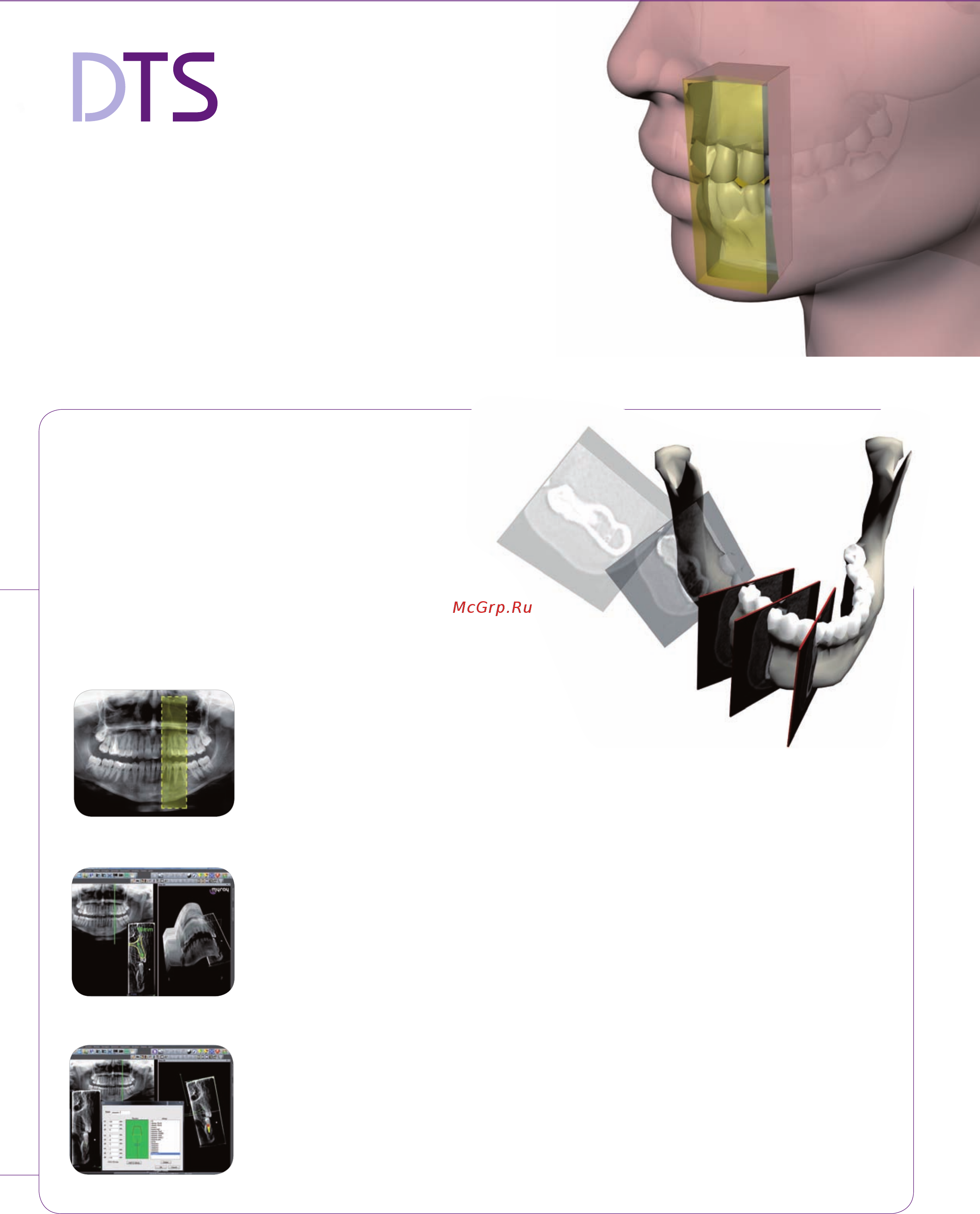 Myray Hyperion X7 [8/8] Динамическое 3d обследование