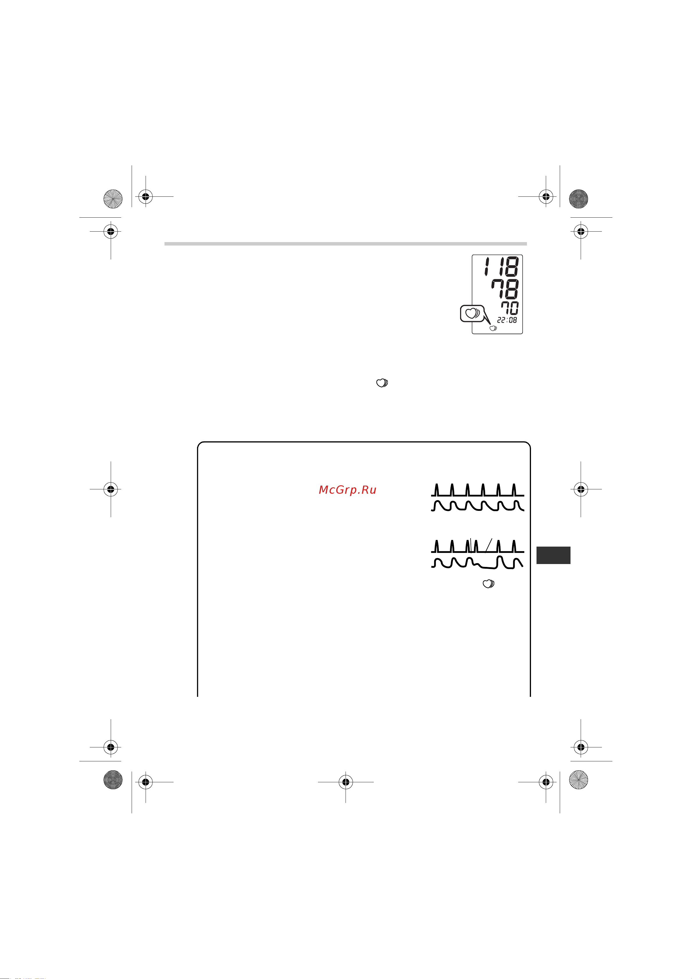 Omron M2 Eco (HEM-7051-RU) [21/84] What is irregular heartbeat