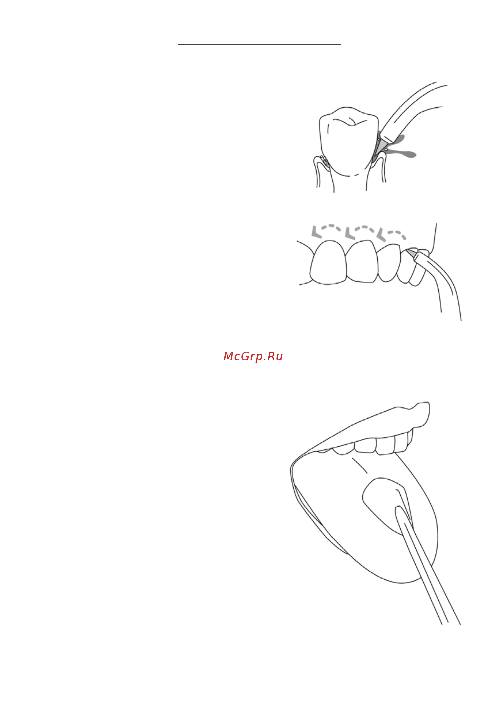 Waterpik WP-112 Ultra Руководство по эксплуатации онлайн [9/11] 752869
