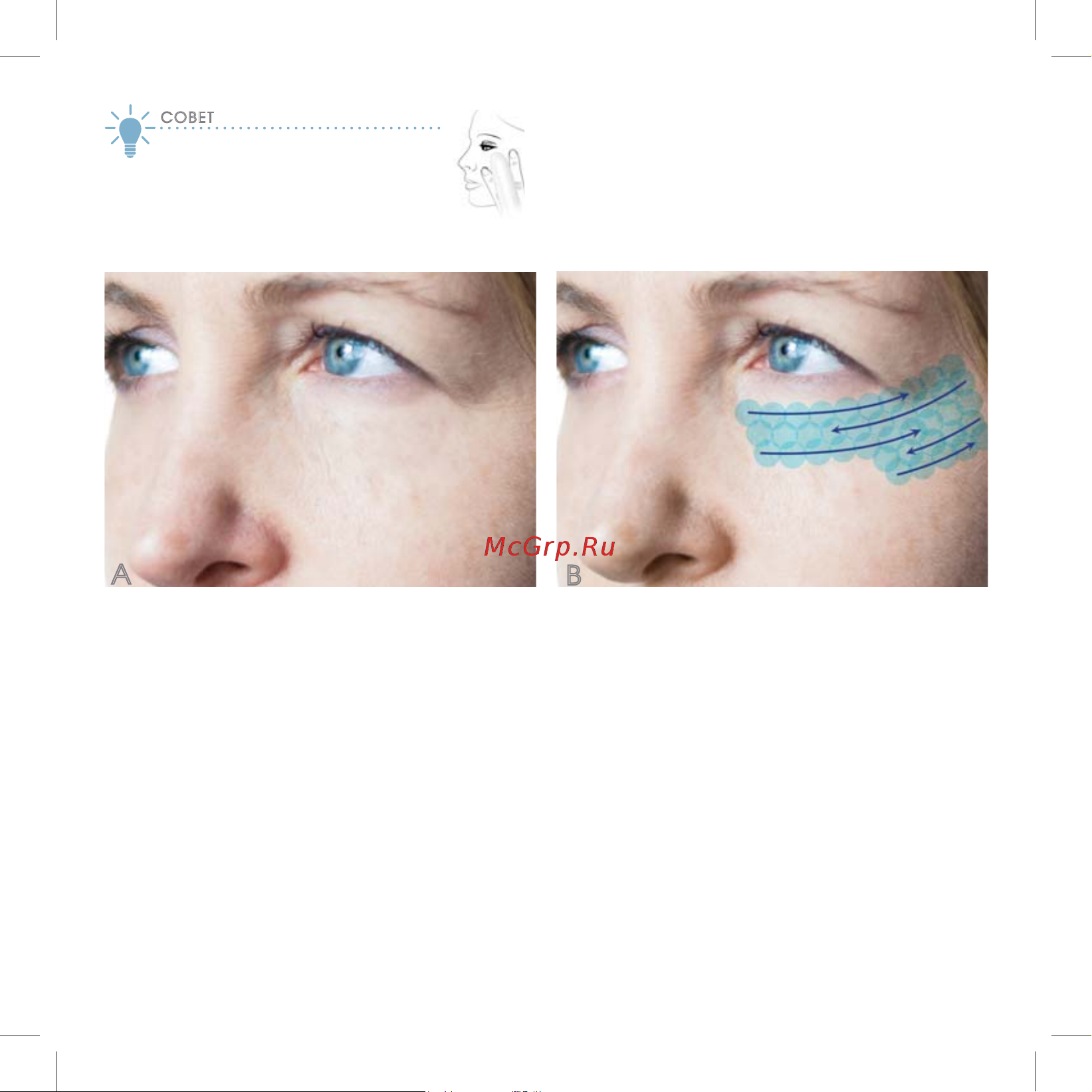 Iluminage Skin Smoothing Laser [48/76] Øàã 3 çîíû ïðèìåíåíèß à è â