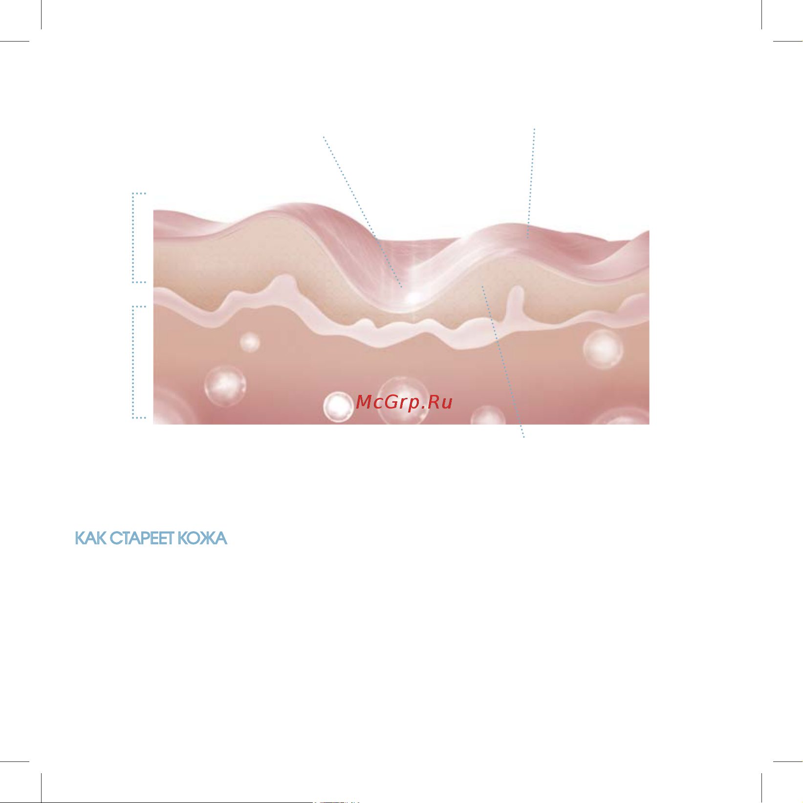 Iluminage Skin Smoothing Laser [6/76] Iluminage_brochure_0611_print pdf