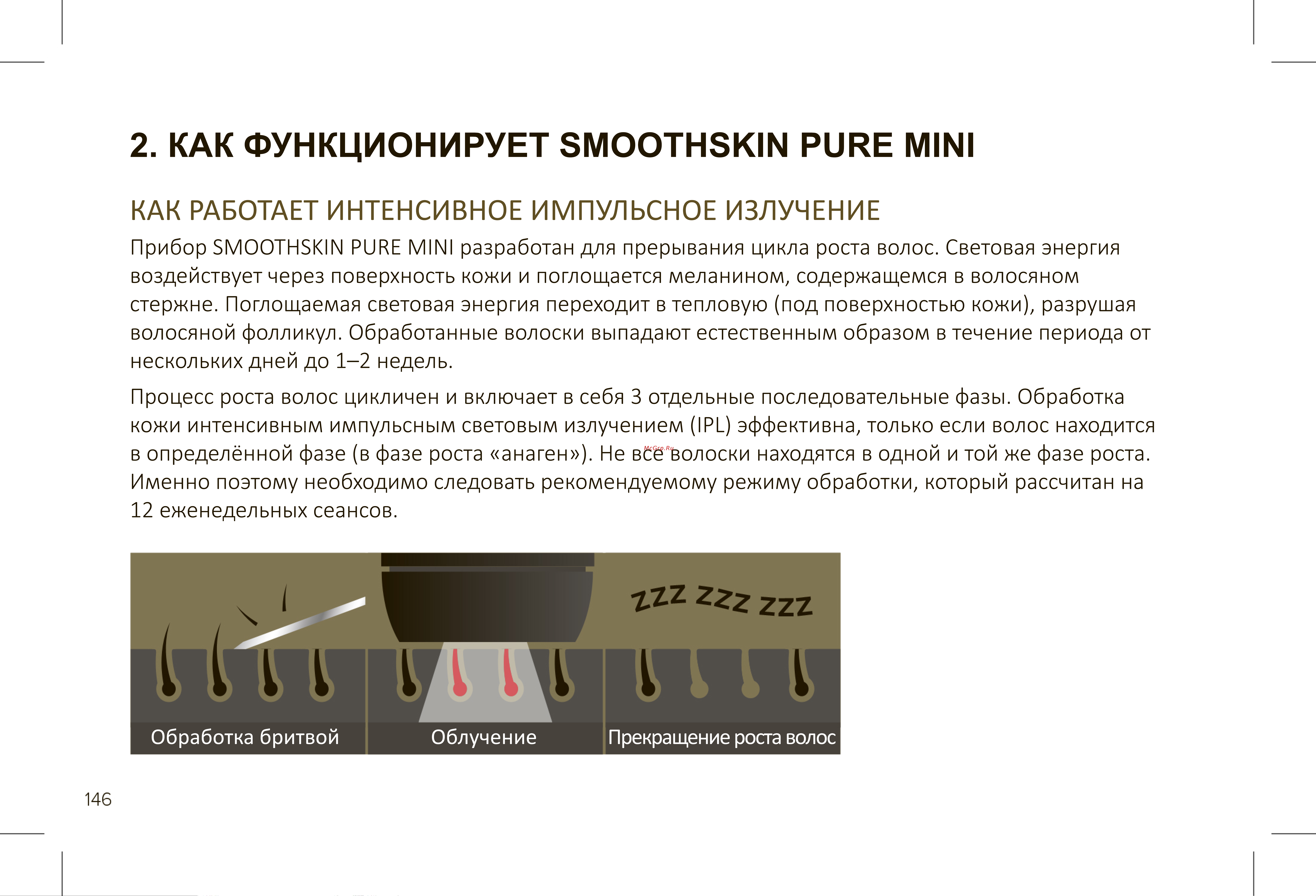 Smoothskin Pure Mini [4/36] Как работает интенсивное импульсное излучение