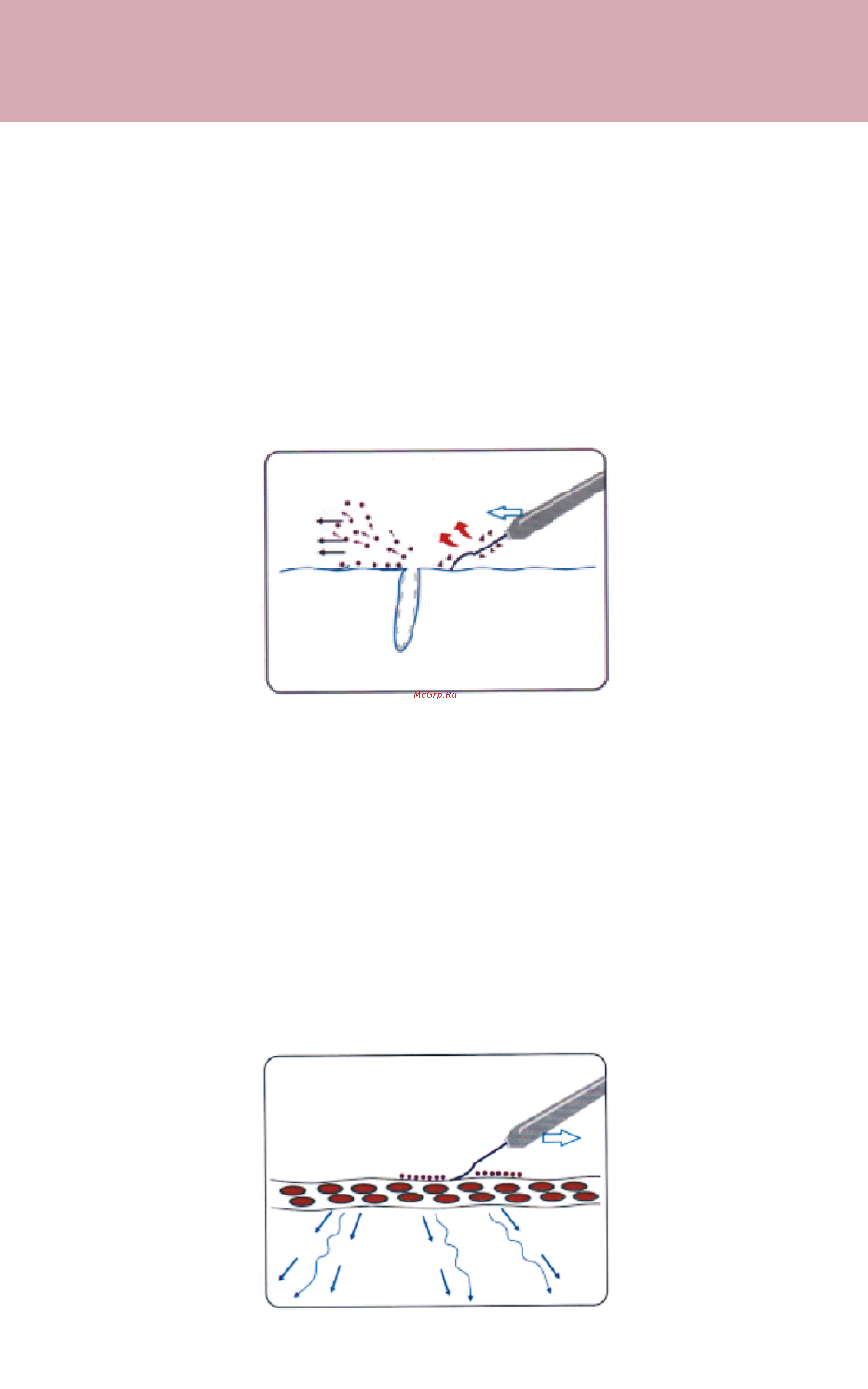 Evo Beauty skinscrubber Руководство по эксплуатации онлайн [3/5] 891088